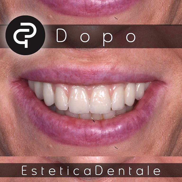 Dopo Dopo