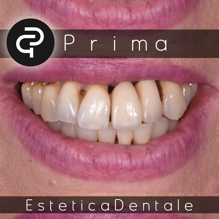 Prima Prima