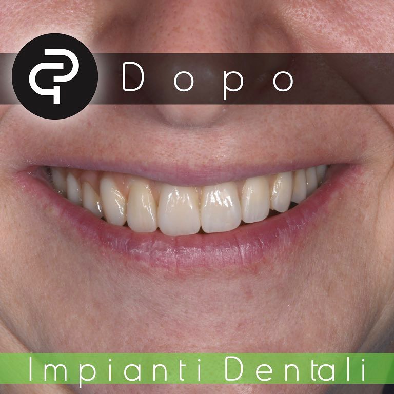 Dopo