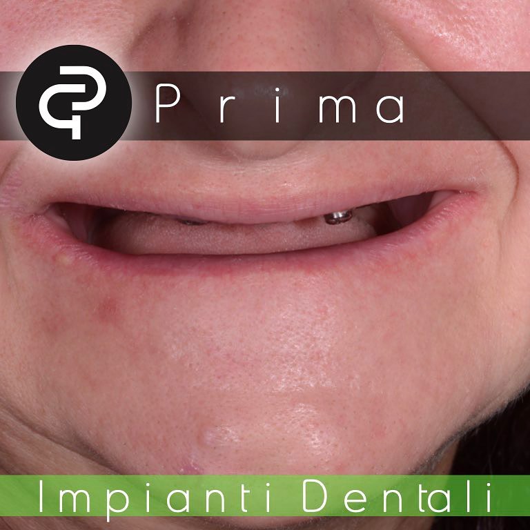 Prima