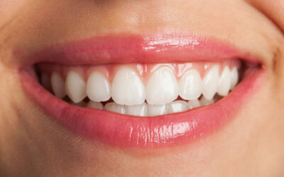 Da senza Denti a denti FISSI grazie agli IMPIANTI dentali