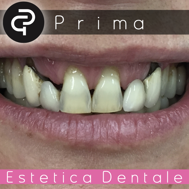 Prima Prima
