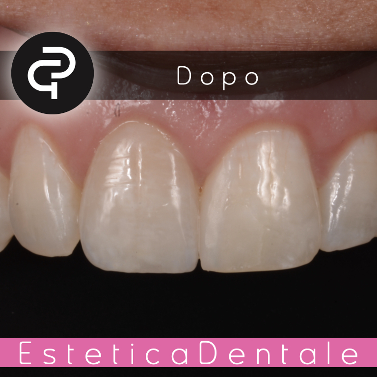 Dopo Dopo