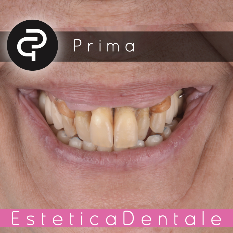 Prima Prima