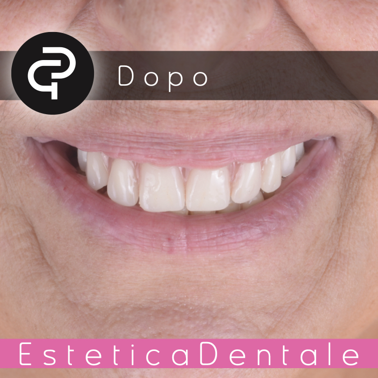 Dopo Dopo