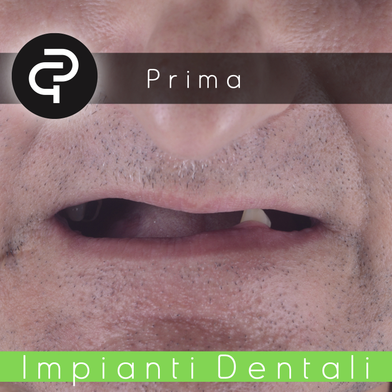 Prima
