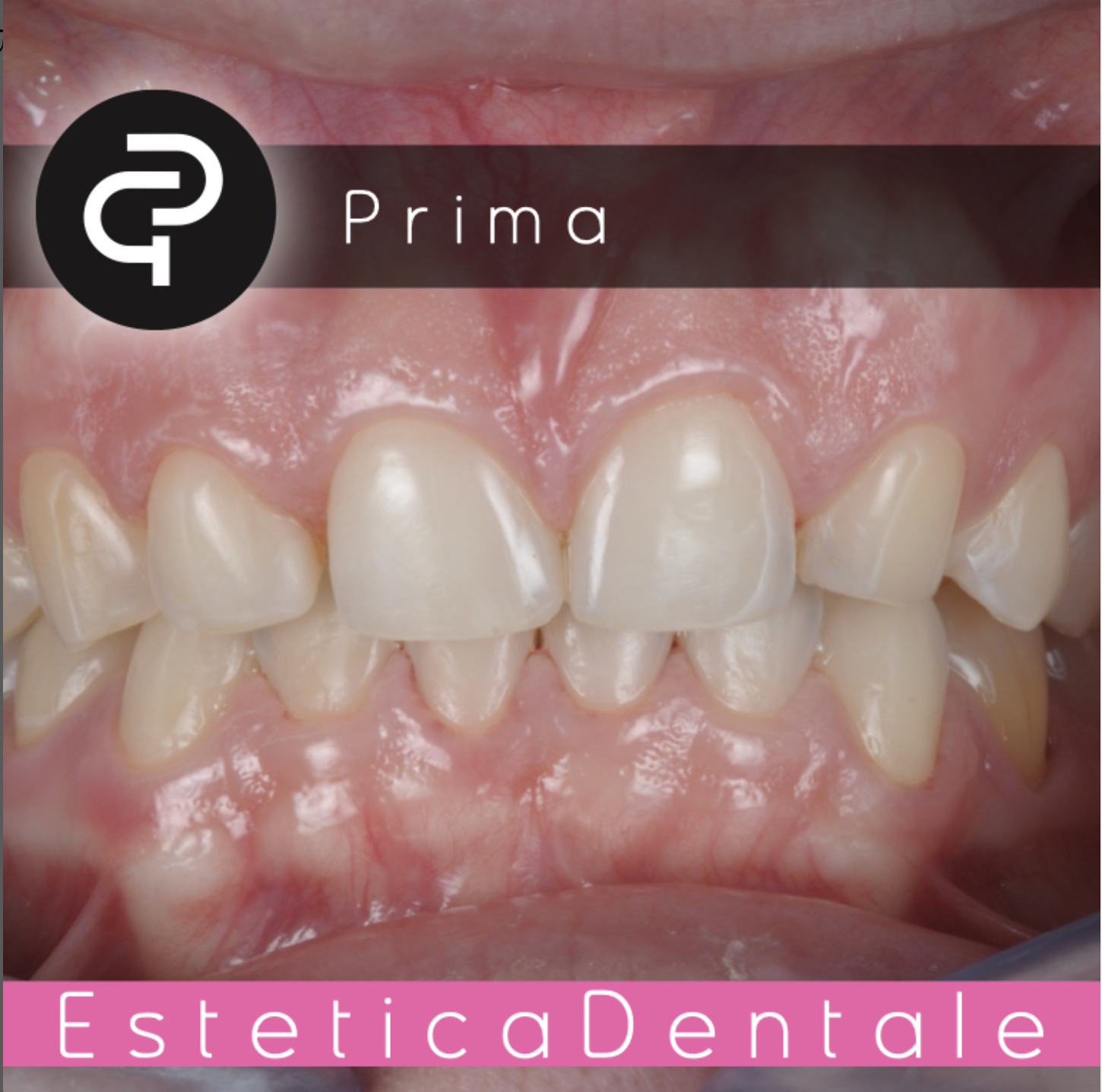 Prima Prima
