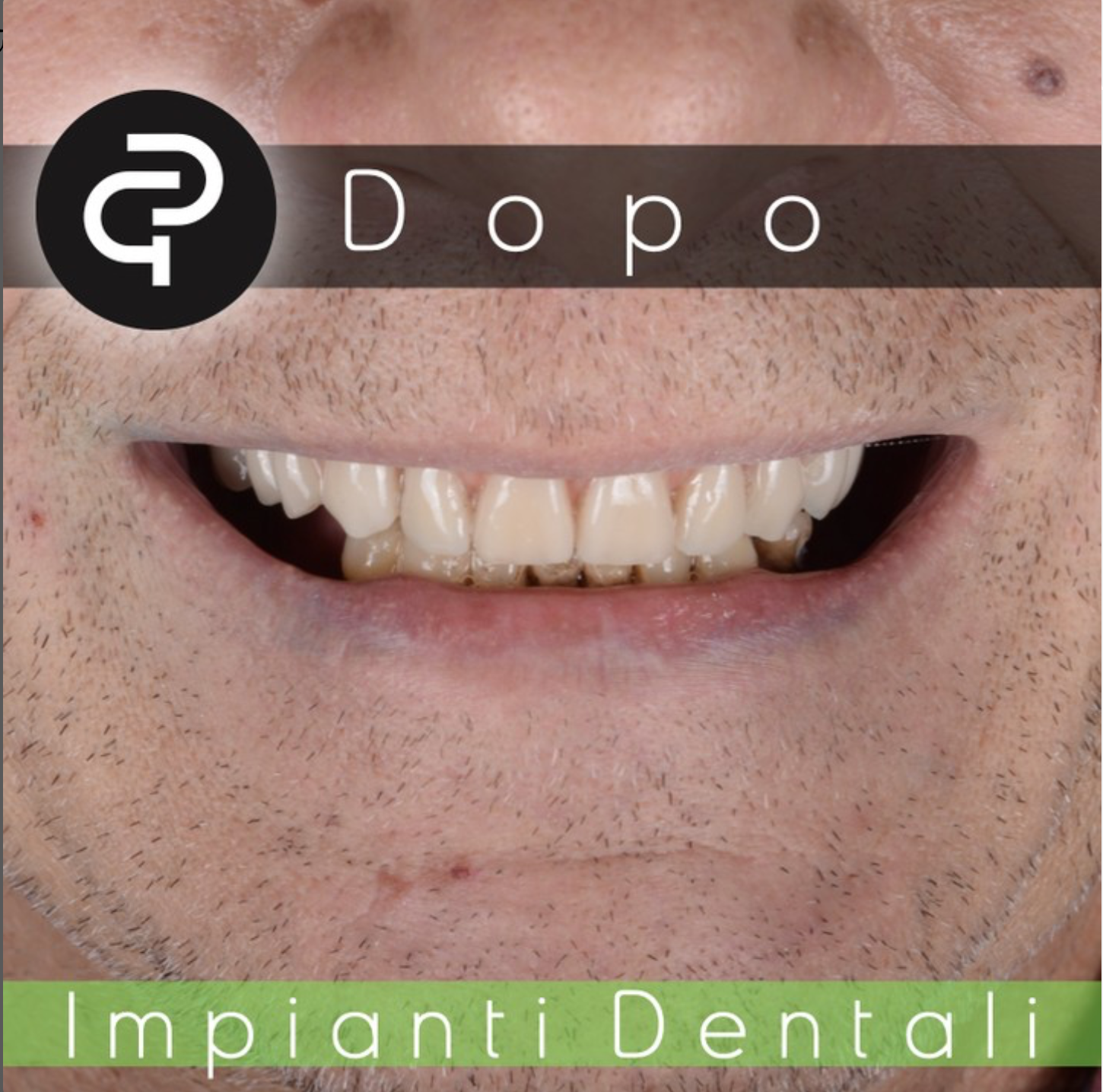 Dopo
