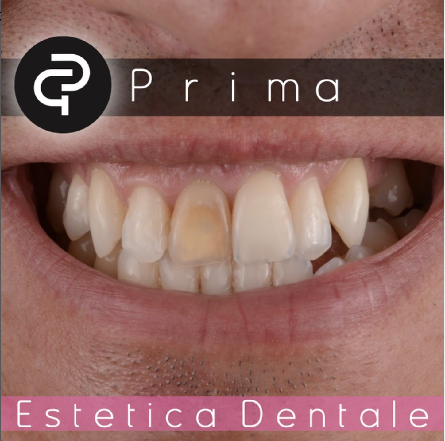 Prima Prima