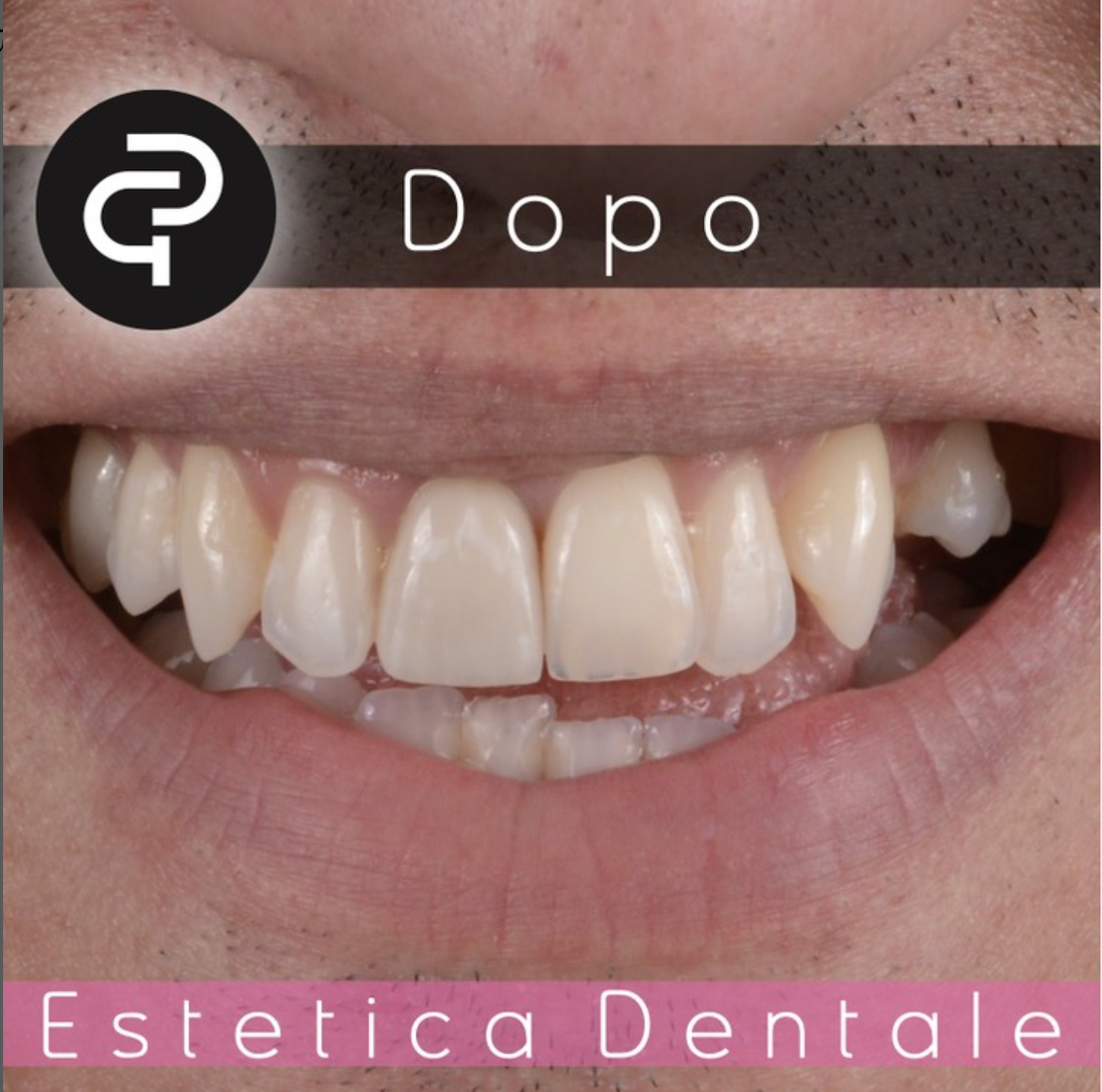 Dopo Dopo