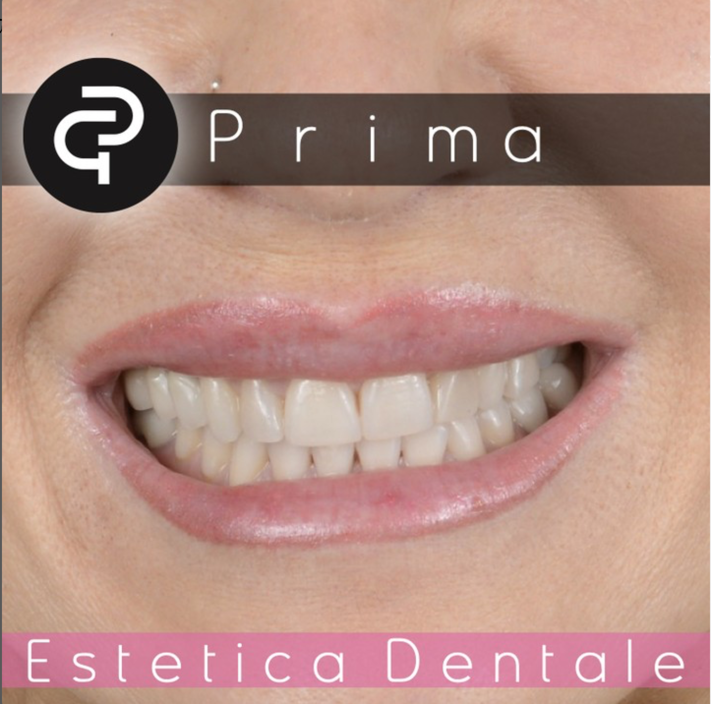 Prima Prima