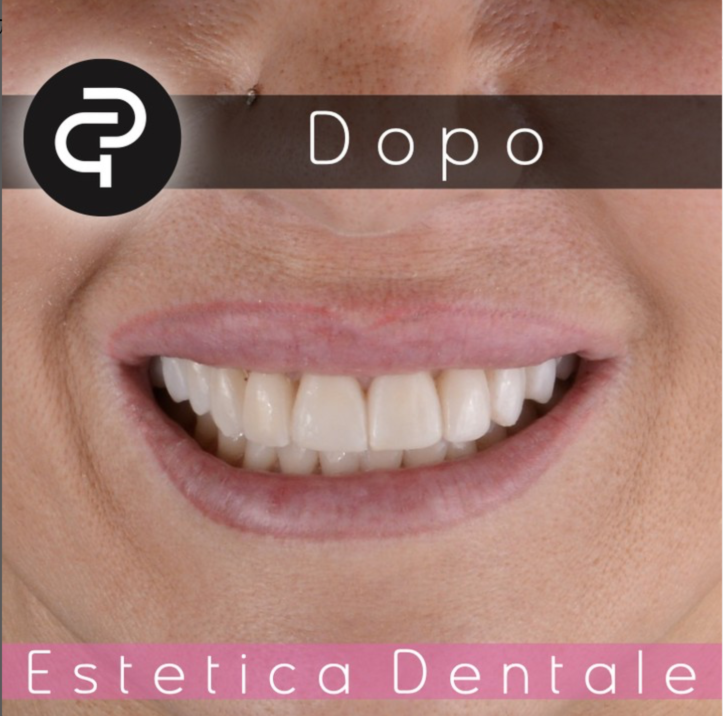 Dopo Dopo