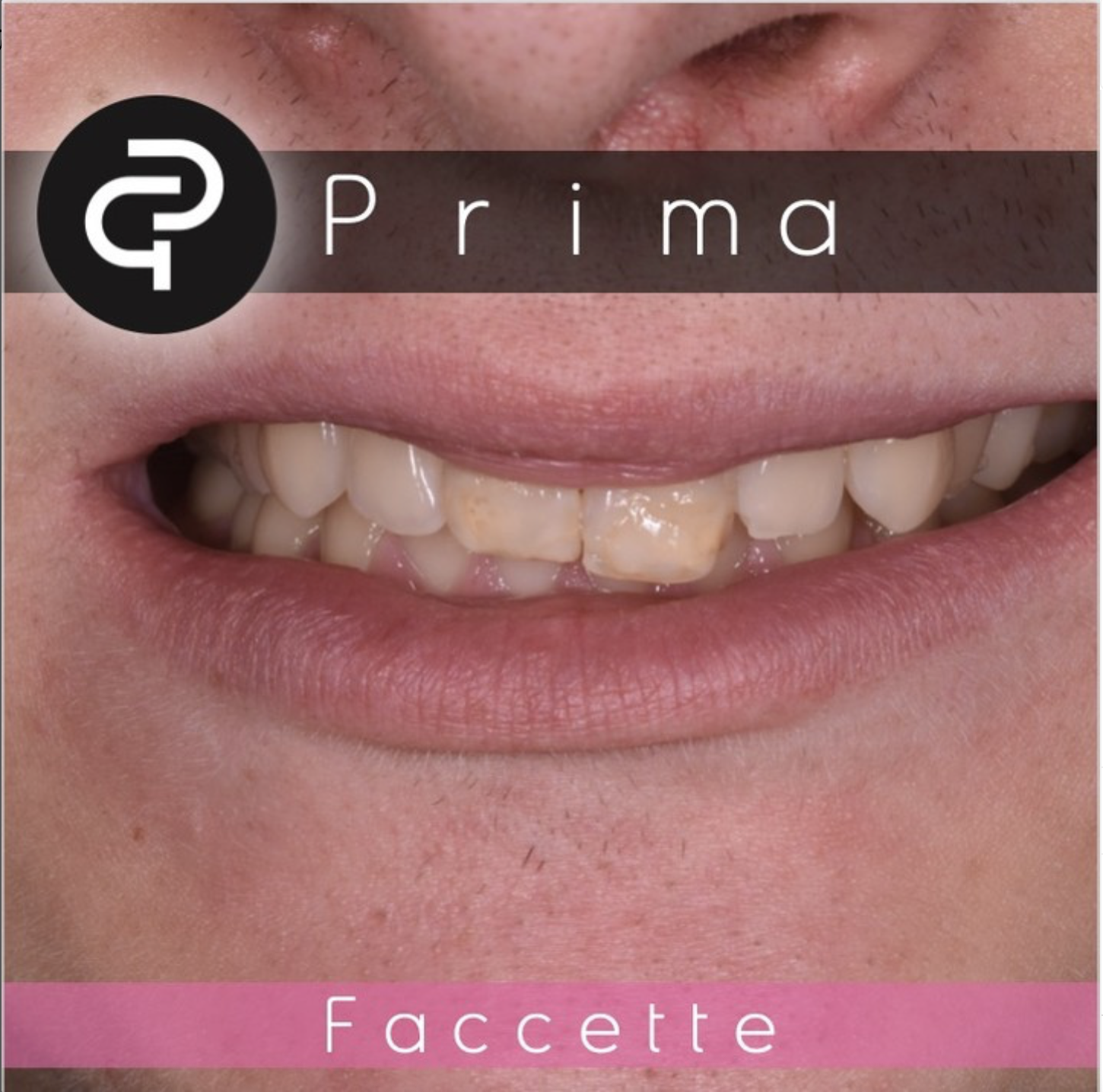 Prima Prima