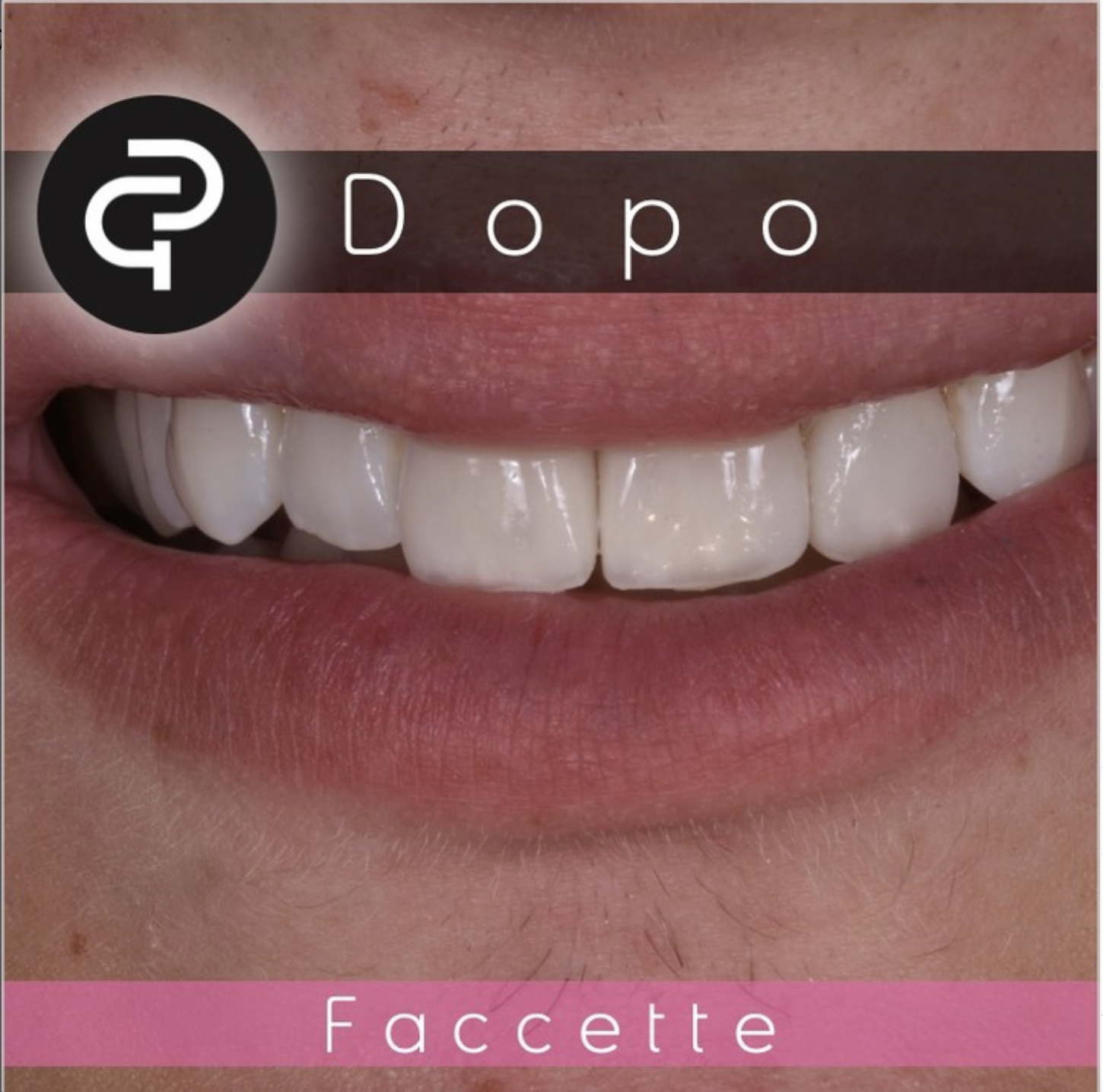 Dopo Dopo