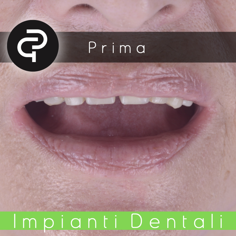 Prima